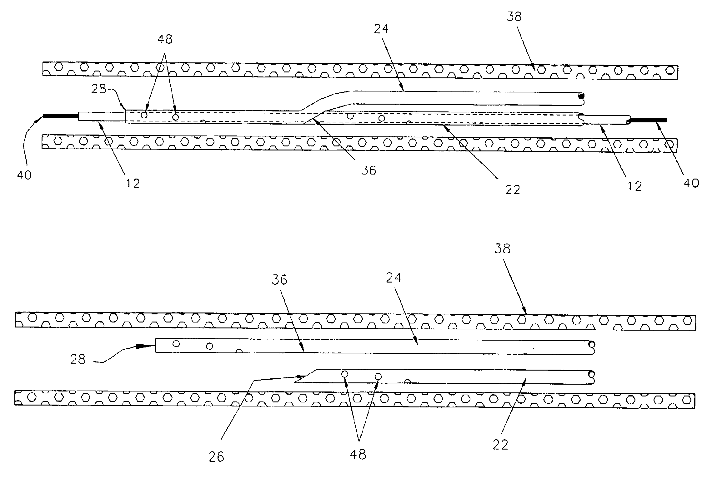 Blood treatment catheter assembly