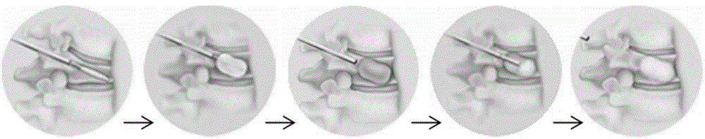 Self-enhanced thin-wall miniature balloon and manufacturing method thereof