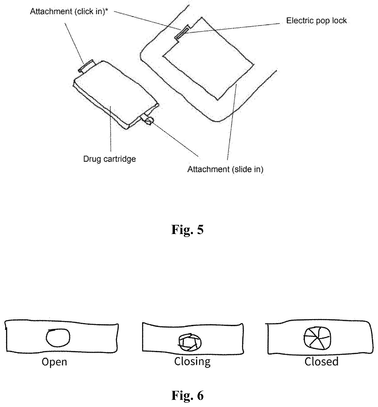 Transdermal drug delivery system