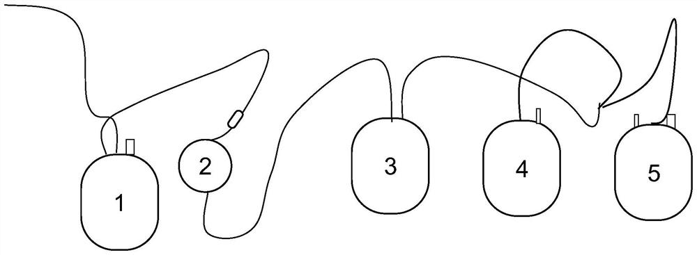 Method for separating mononuclear cells from whole blood collection device for blood donation