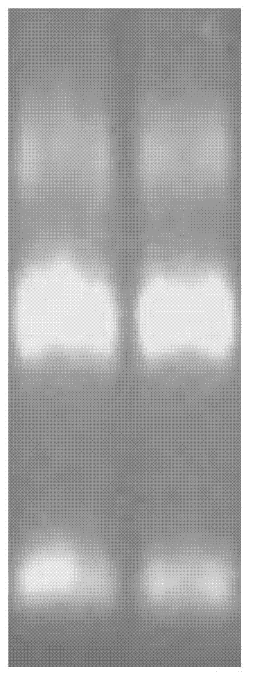 Method for screening natural antisense transcripts related to human tumor