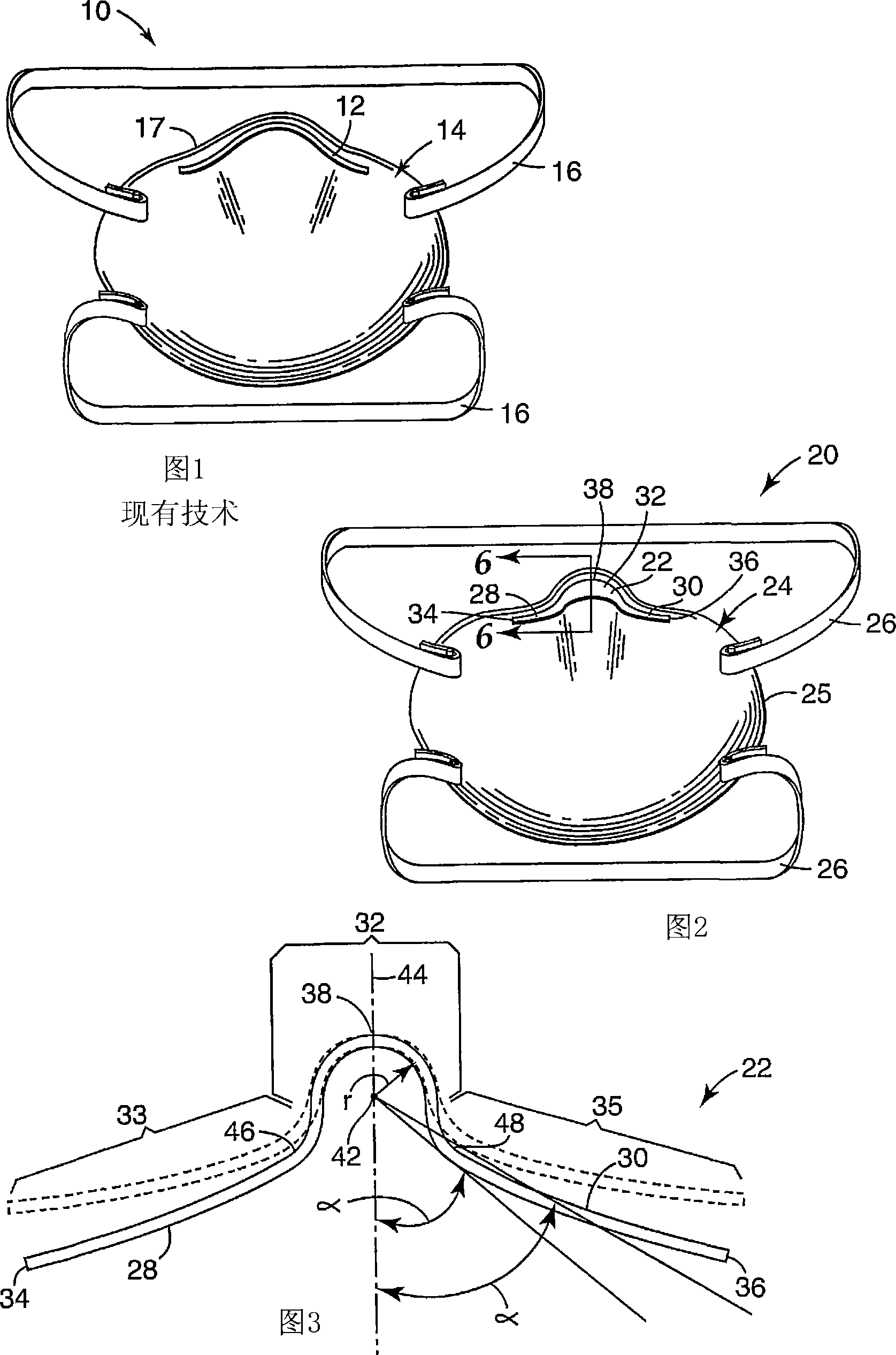 Respirator having preloaded nose clip