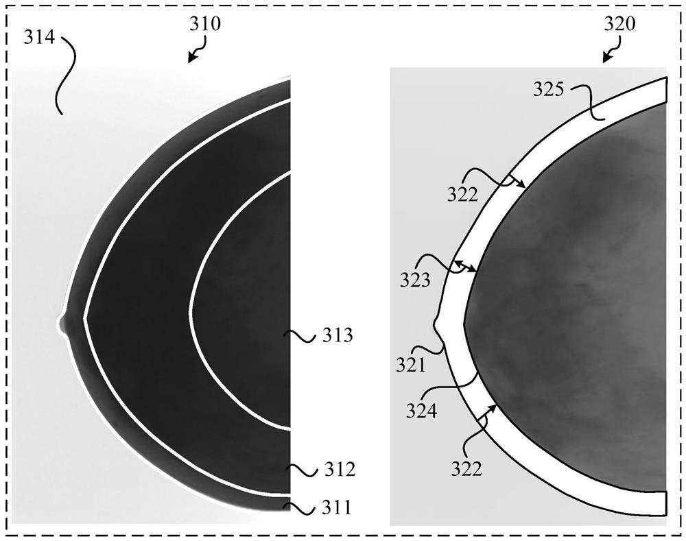 Breast image processing method, device and breast imaging equipment