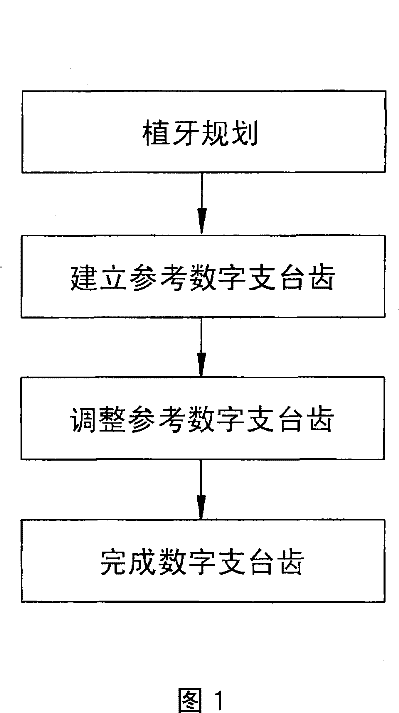 Digital supporting tooth design method by digital tooth implantation technology