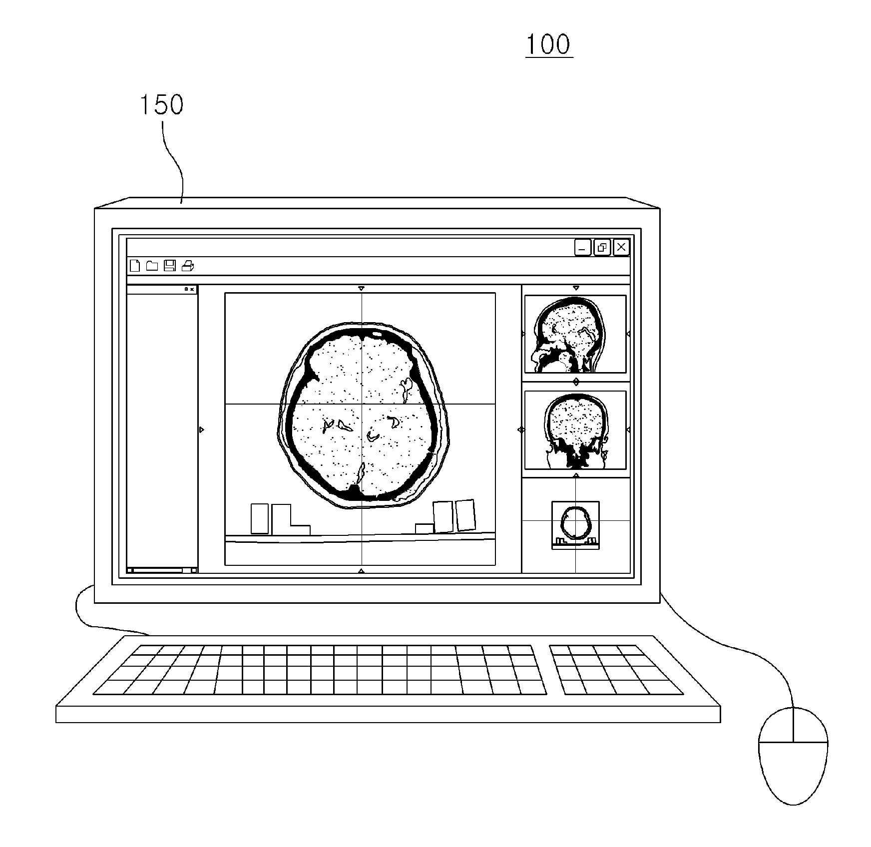 Apparatus for evaluating radiation therapy plan and method therefor