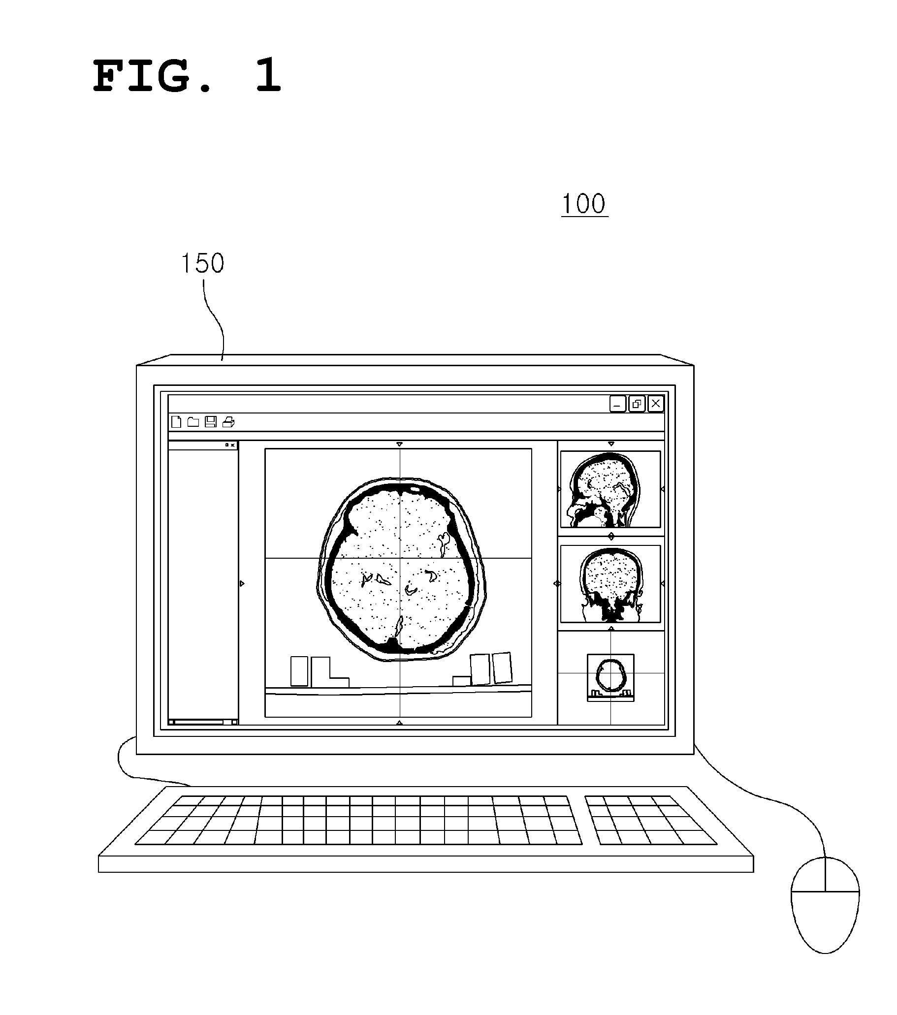 Apparatus for evaluating radiation therapy plan and method therefor