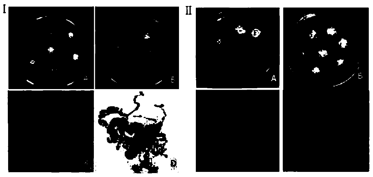 Method for ultralow-temperature preservation of anti-bursaphelenchus-xylophilus pinus massoniana embryonic callus