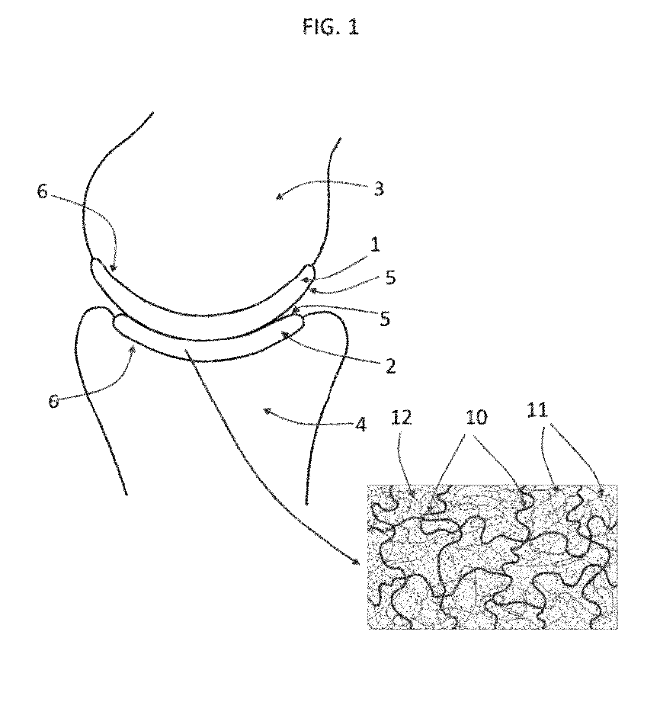 Hydrogel arthroplasty device