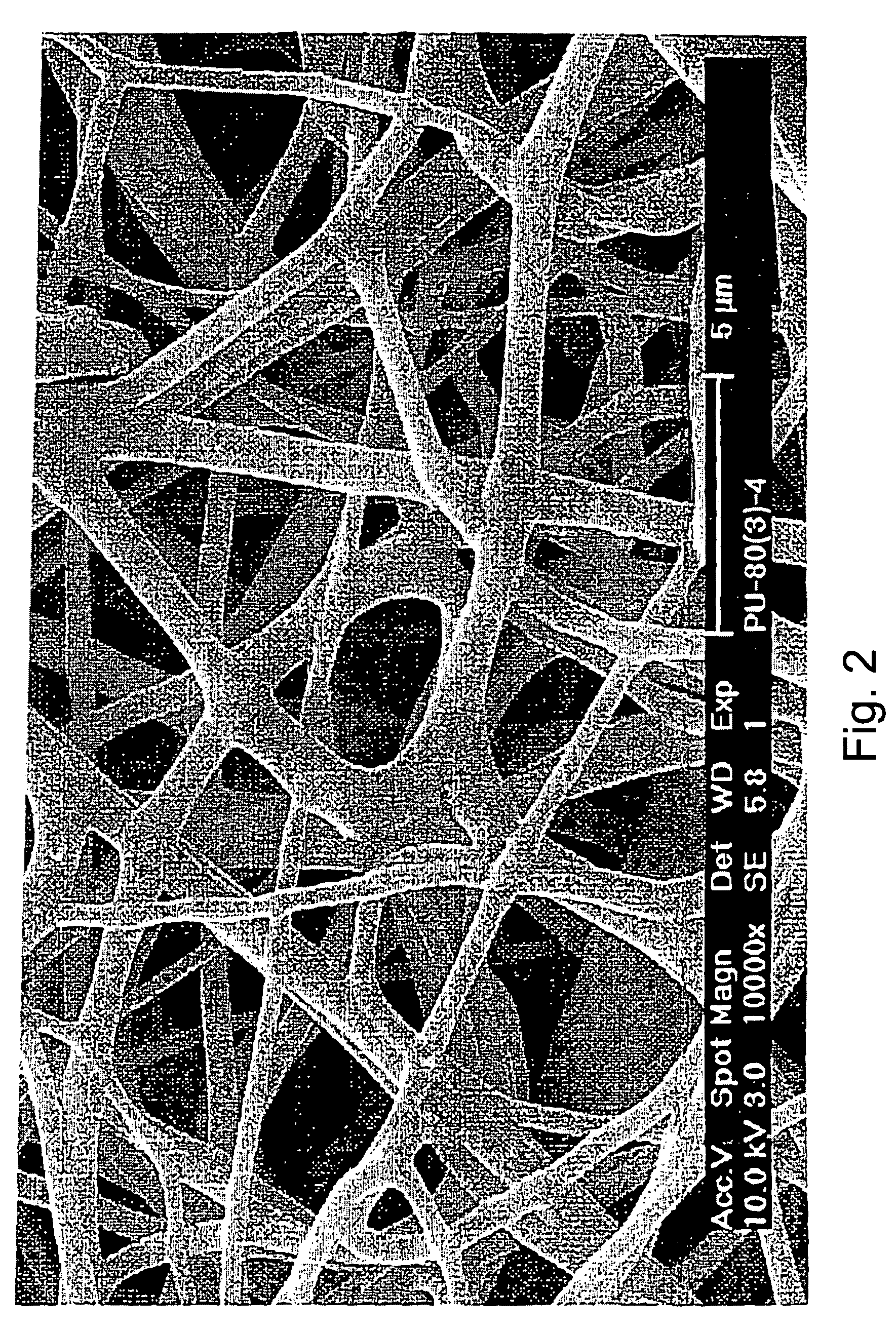 Vascular prosthesis and method for production thereof