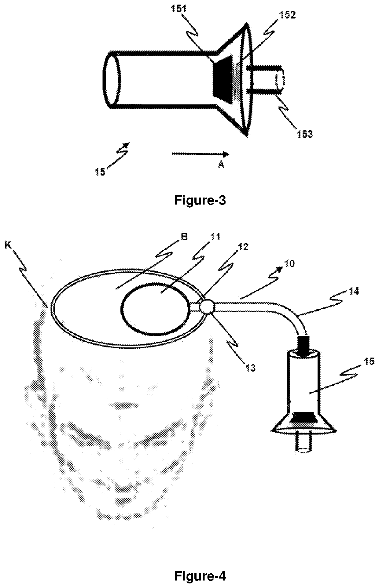 Pressure-regulated balloon apparatus positioned in the cavity formed in the brain after surgery