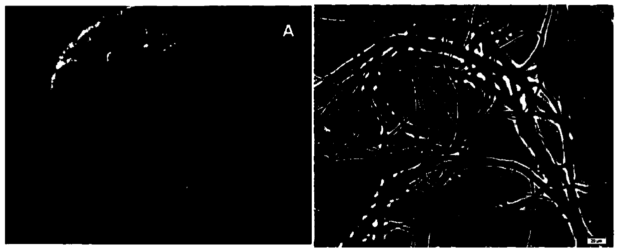 Radix astragali root source pyrenochaeta for efficiently inhibiting botrytis cinerea and application for radix astragali root source pyrenochaeta