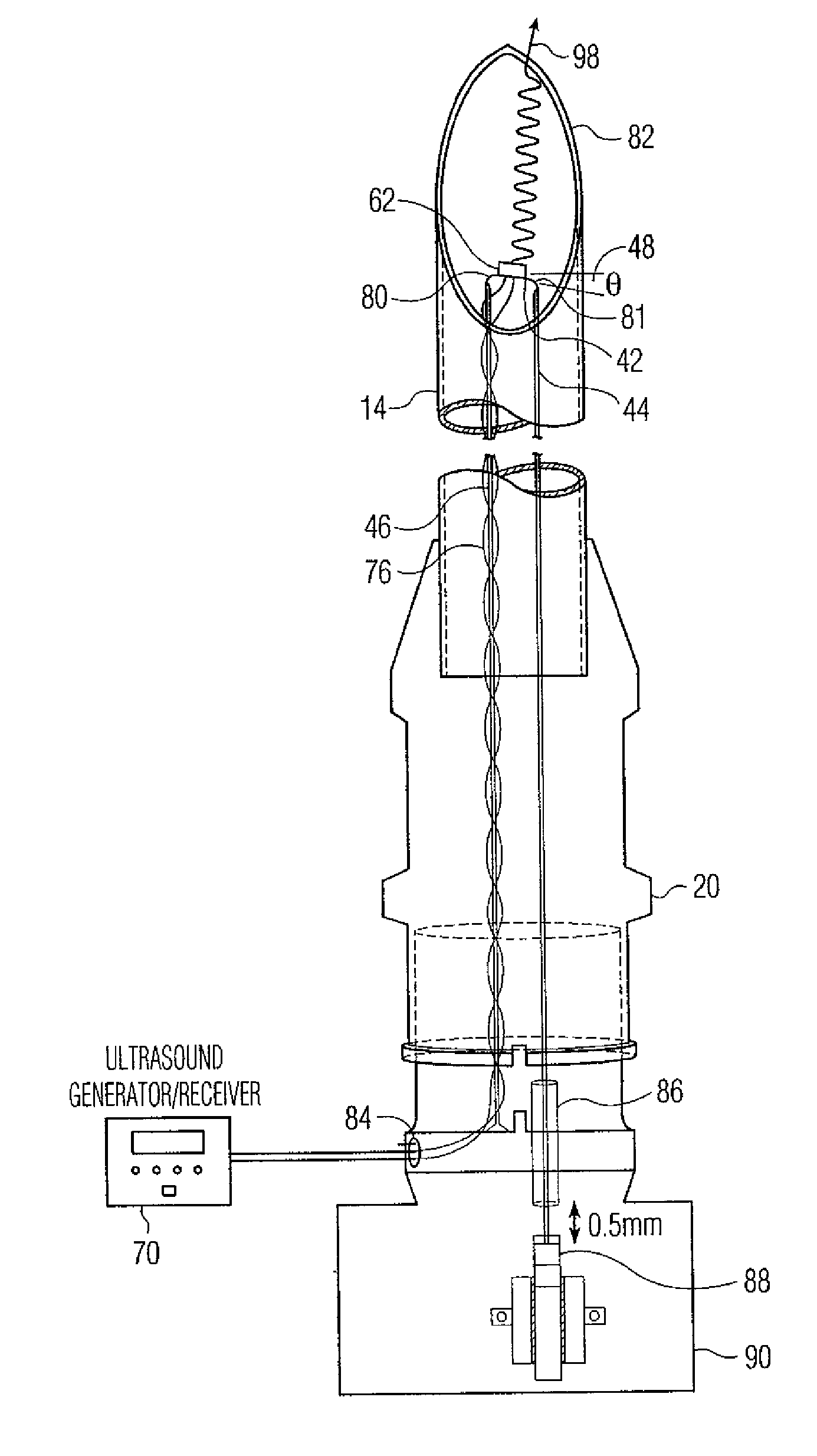 Regional anesthetic method and apparatus