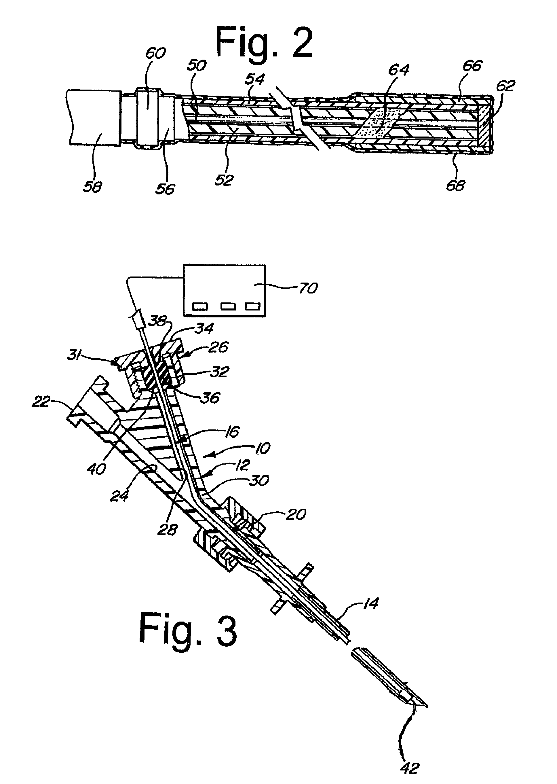 Regional anesthetic method and apparatus