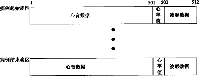 Method for synchronously storing and playing back fetal heart sound, heartbeat waveform and heart rate values