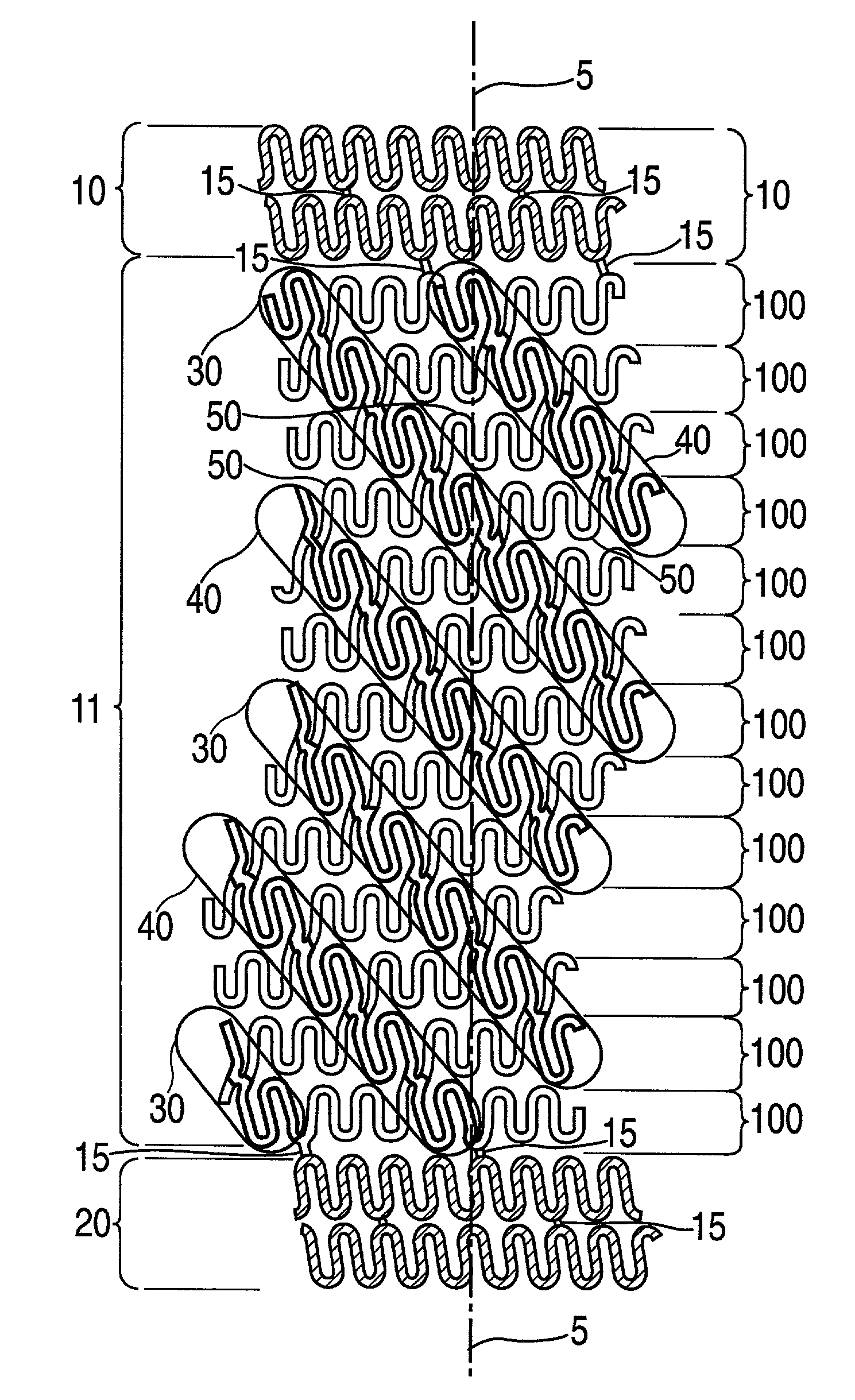 Stent having helical elements