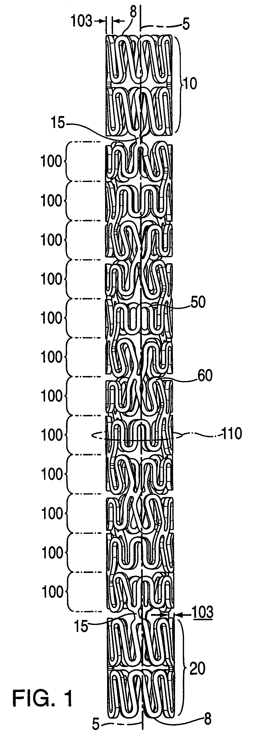 Stent having helical elements