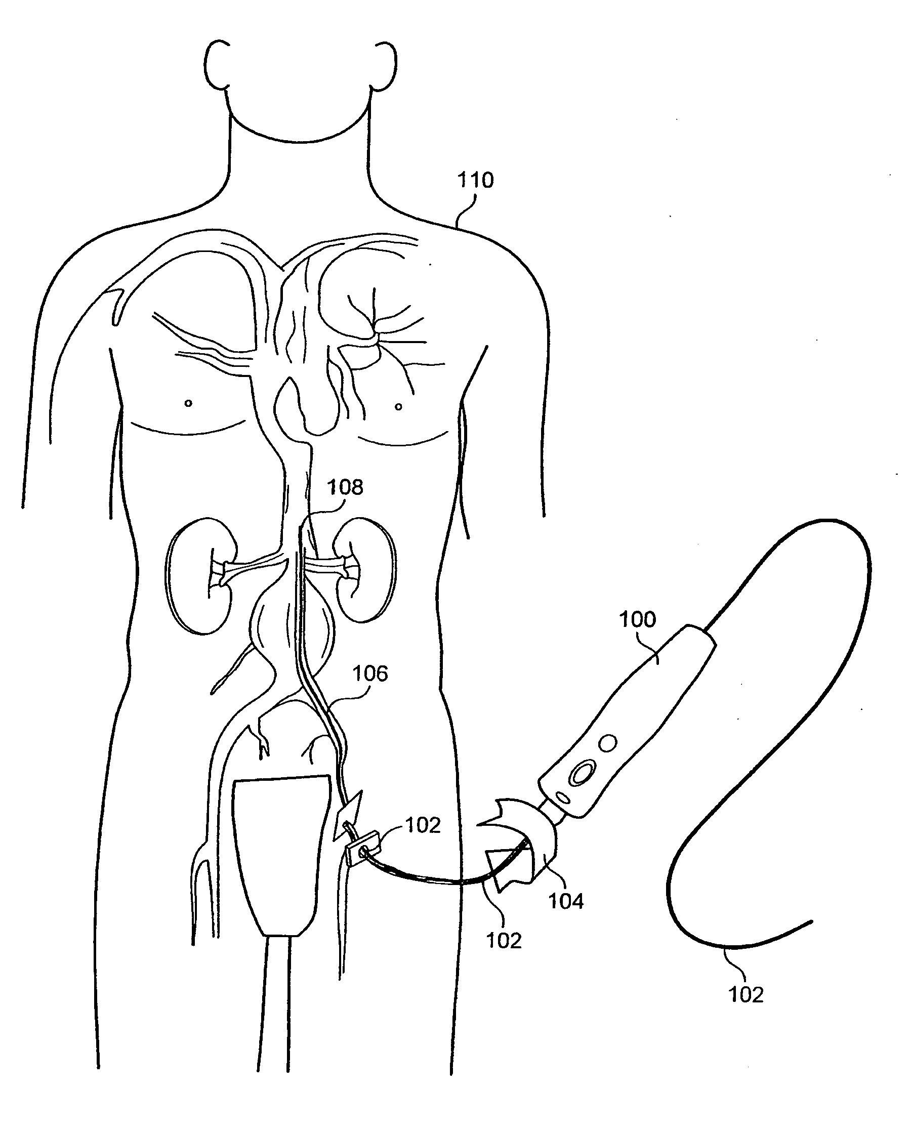 Method and apparatus for manipulating a surgical guidewire