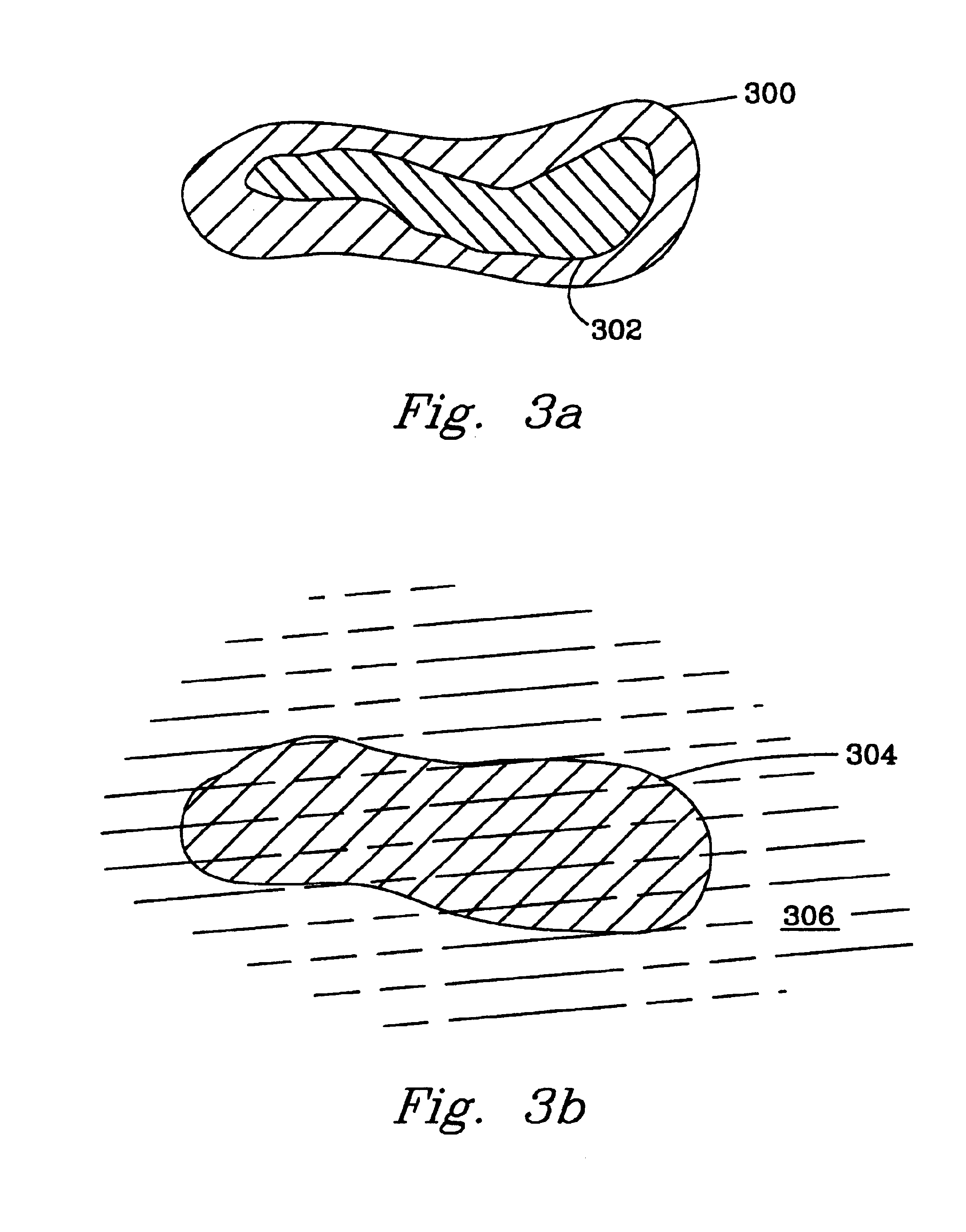 Stimulus sensitive gel with radioisotope and methods of making