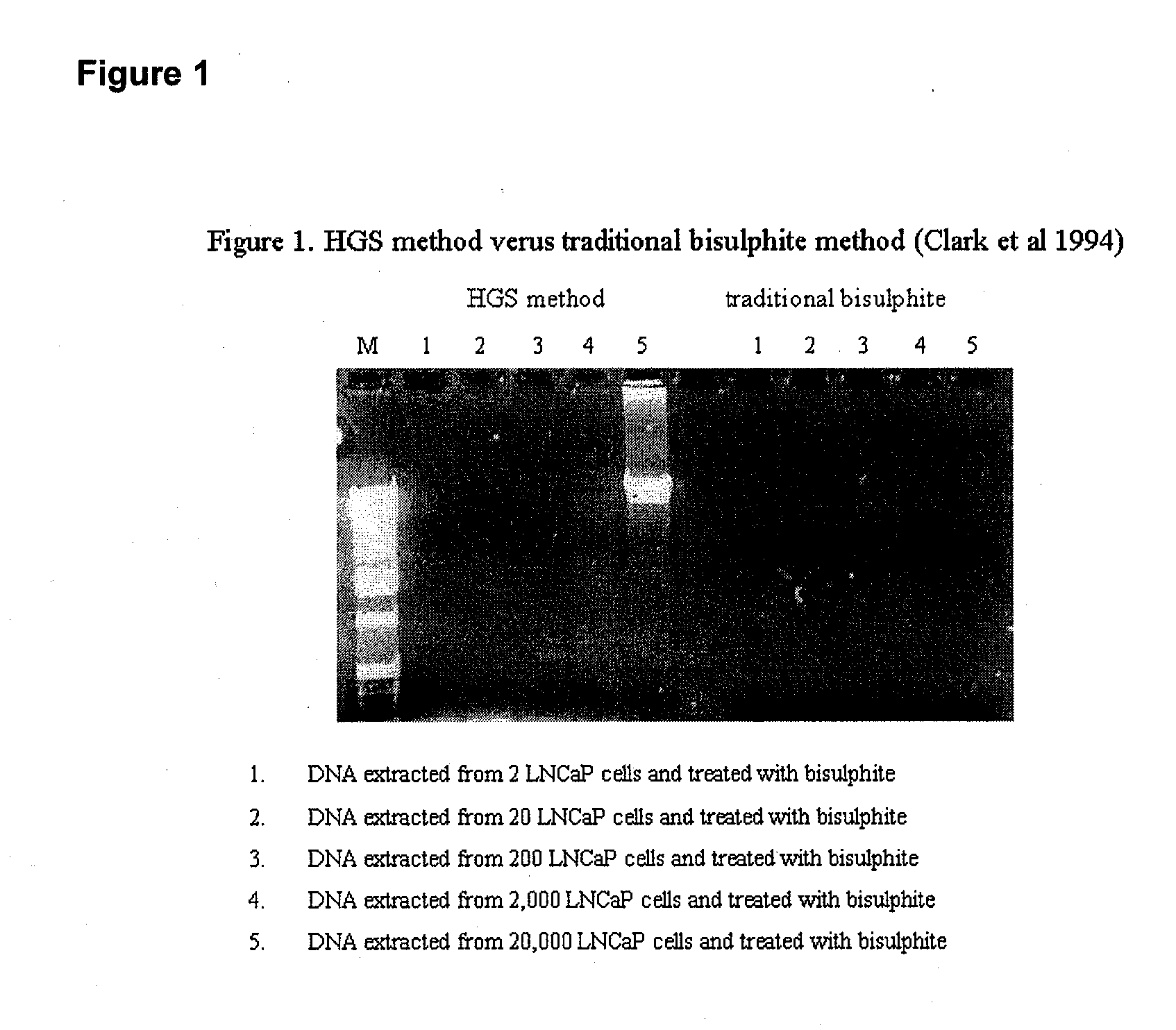 Treatment of nucleic acid