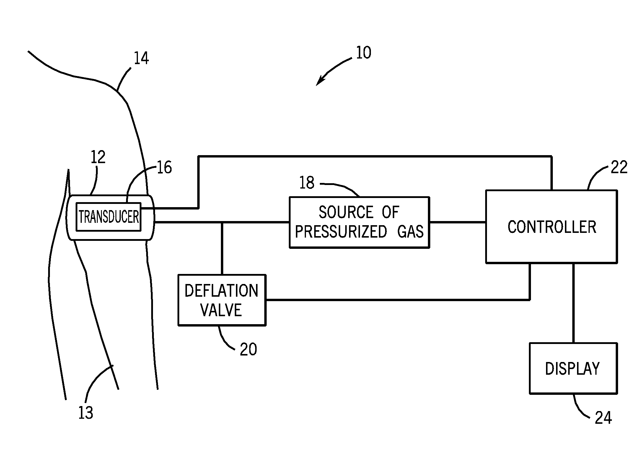 Method and system for non-invasive blood pressure determination