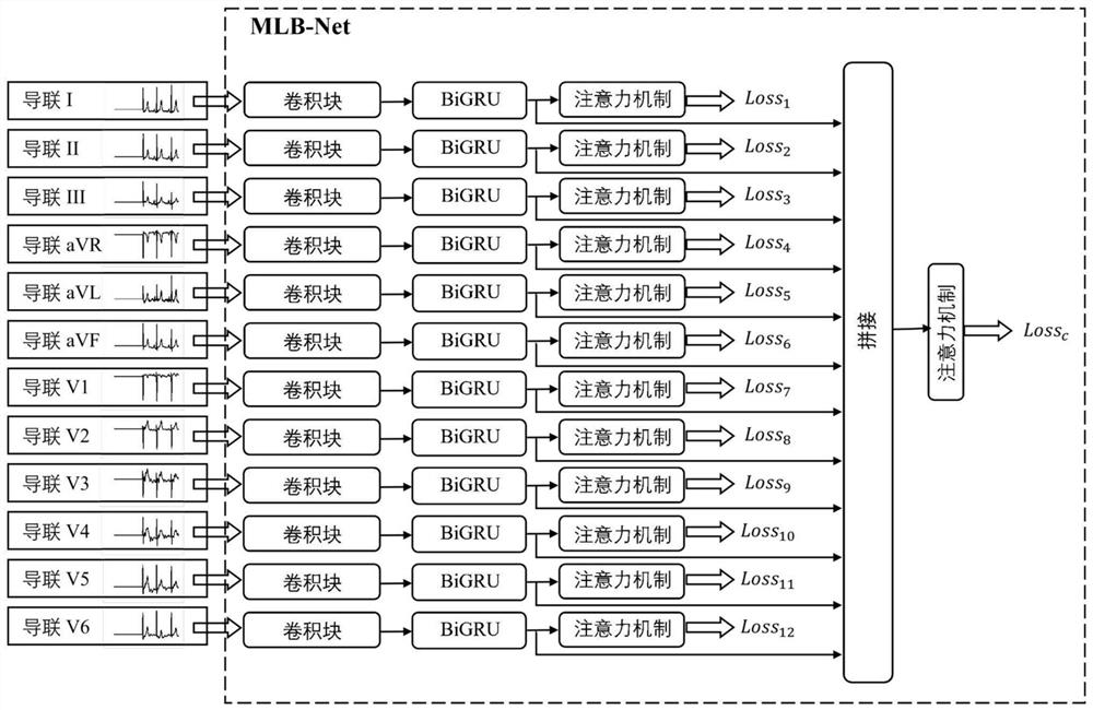 Arrhythmia classification method based on multilead information fusion