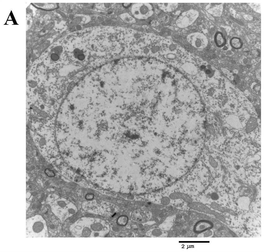 A traditional Chinese medicine composition for treating ischemic cerebrovascular disease and its application