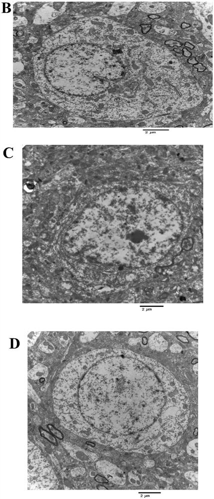 A traditional Chinese medicine composition for treating ischemic cerebrovascular disease and its application