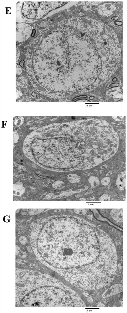 A traditional Chinese medicine composition for treating ischemic cerebrovascular disease and its application