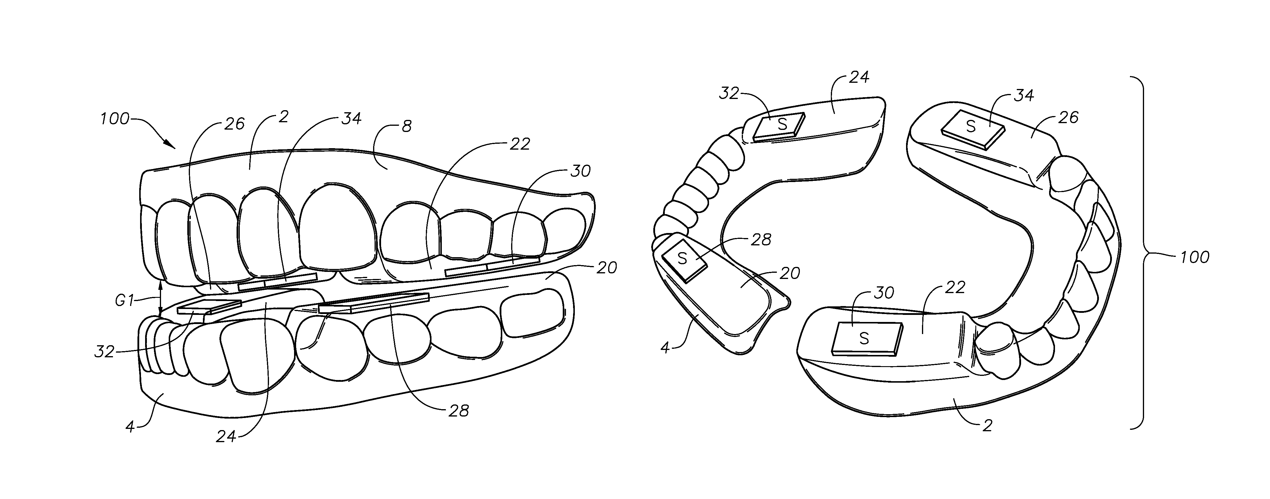 Oral devices, kits, and methods for reducing sleep apnea, snoring, and/or nasal drainage