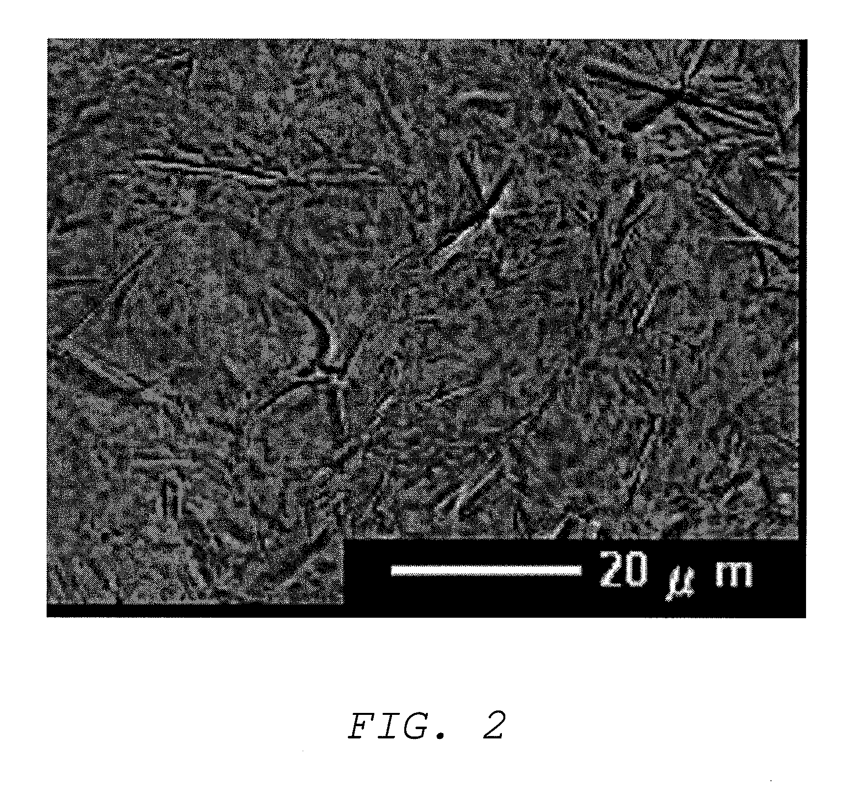 Oil base and external preparation containing same