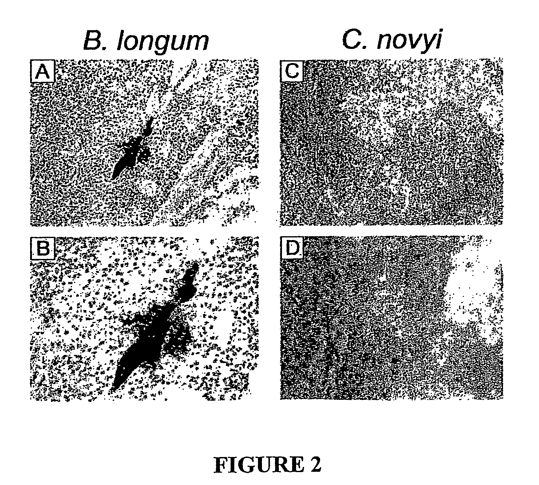 Combination bacteriolytic therapy for the treatment of tumors