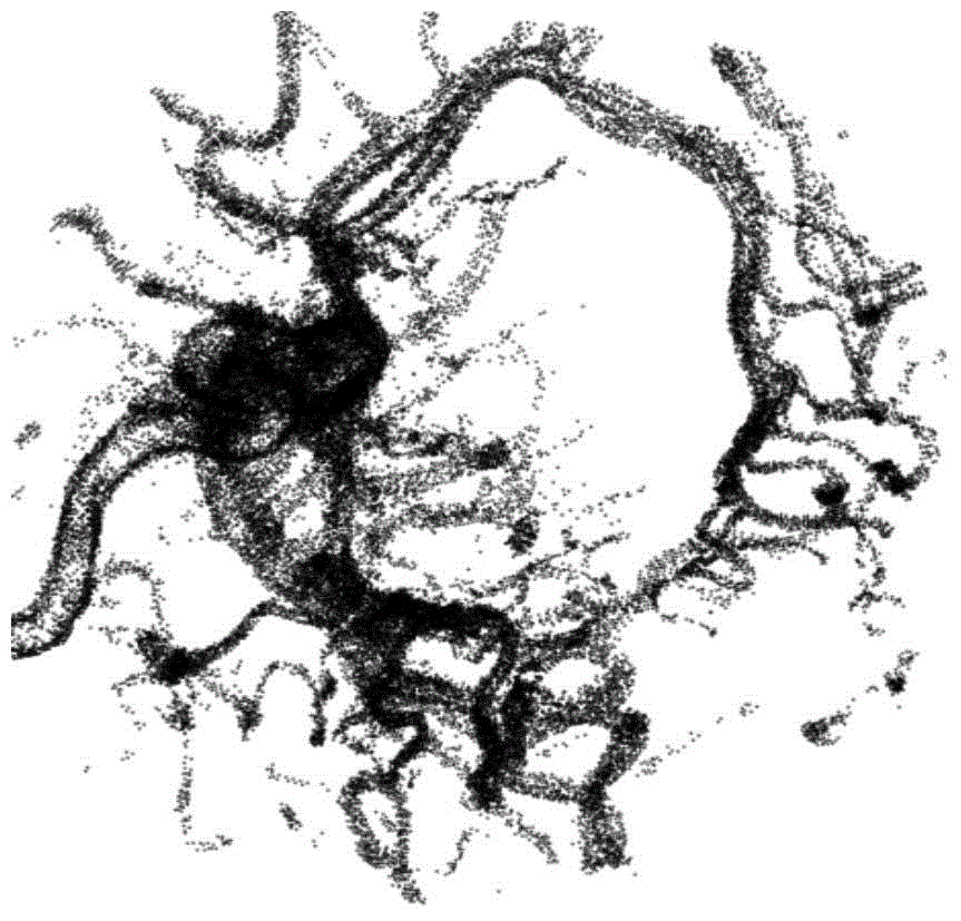 Organ skeleton extraction method based on medical images