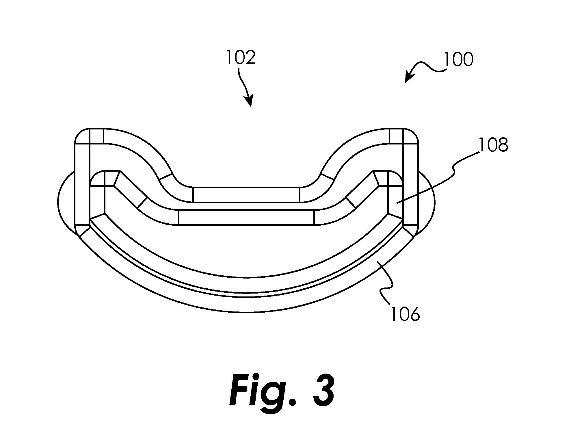 Plasma resection electrode