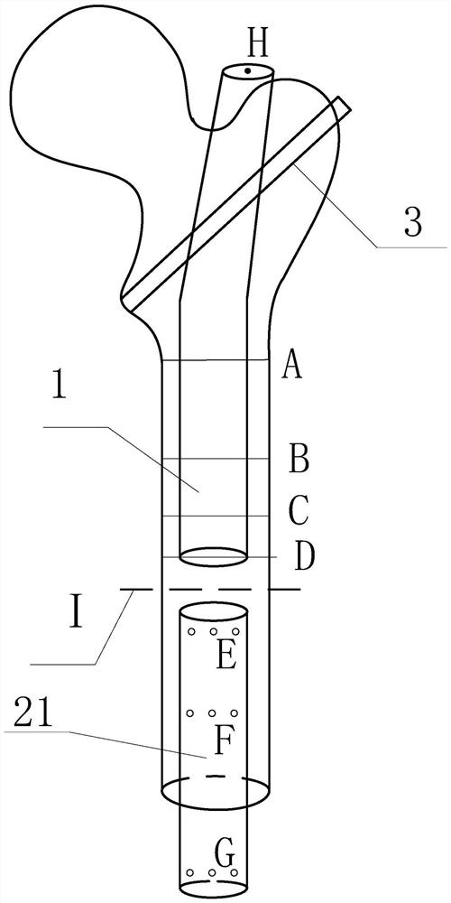 Implantable prosthetic device capable of lengthening amputation stump at middle-upper section of femur