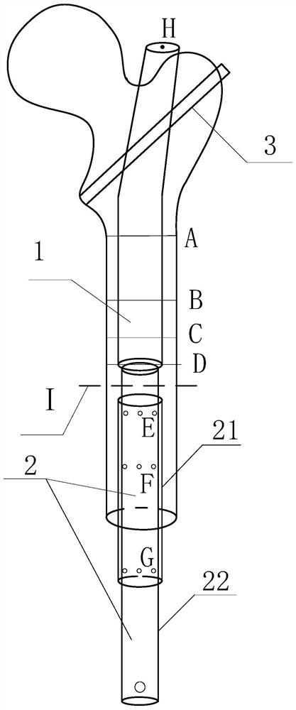 Implantable prosthetic device capable of lengthening amputation stump at middle-upper section of femur