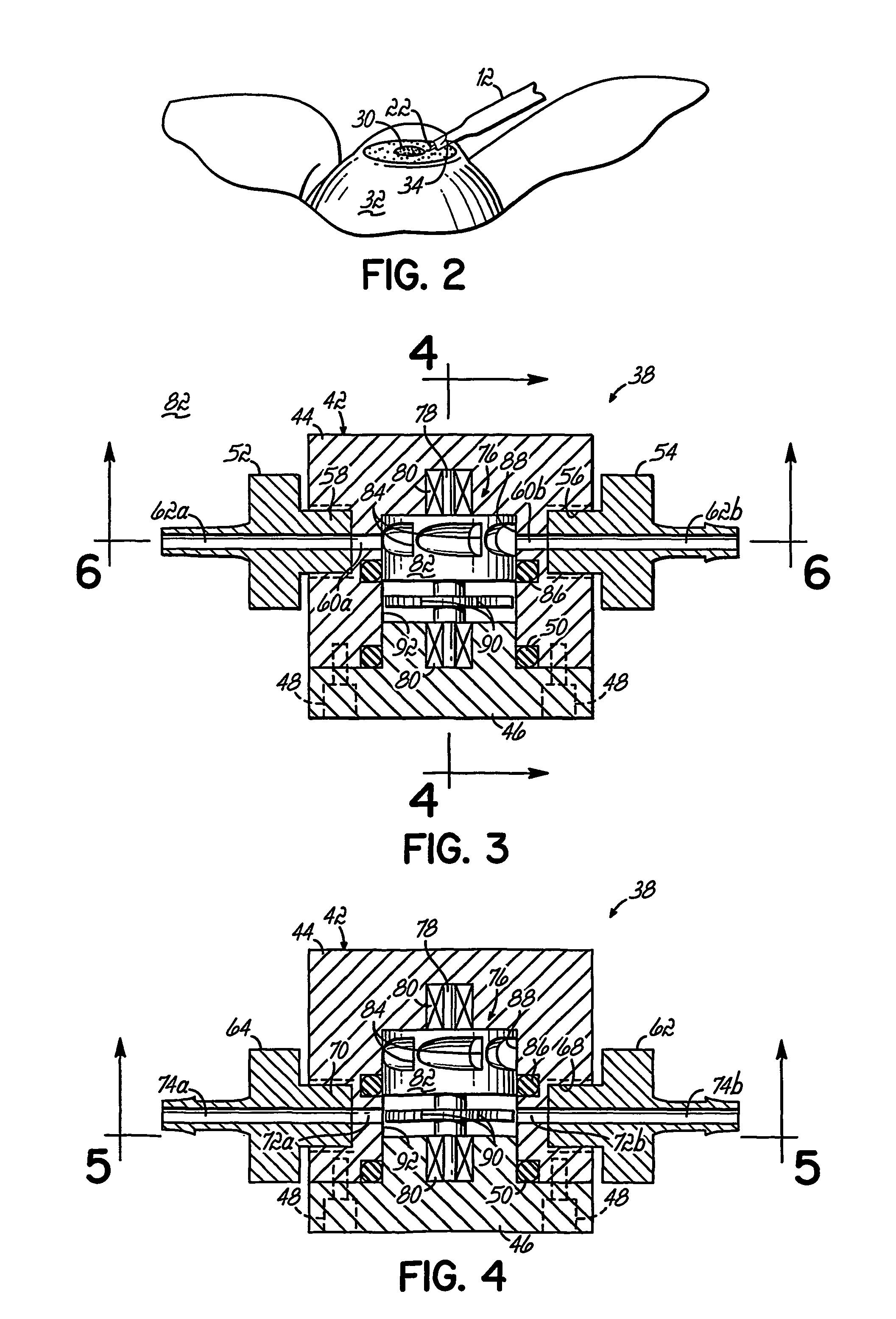 Surge-flow regulator for use in ophthalmic surgical aspiration