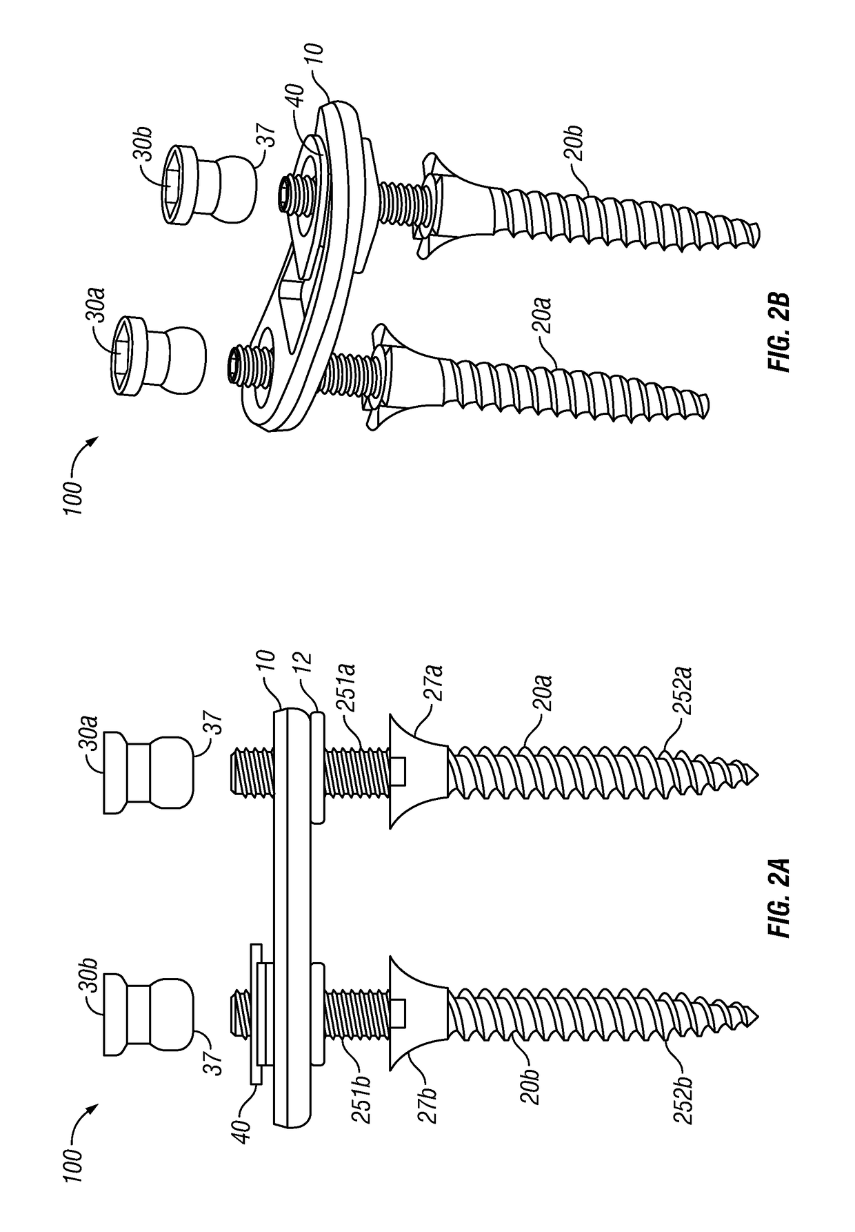 Posterior lumbar plate