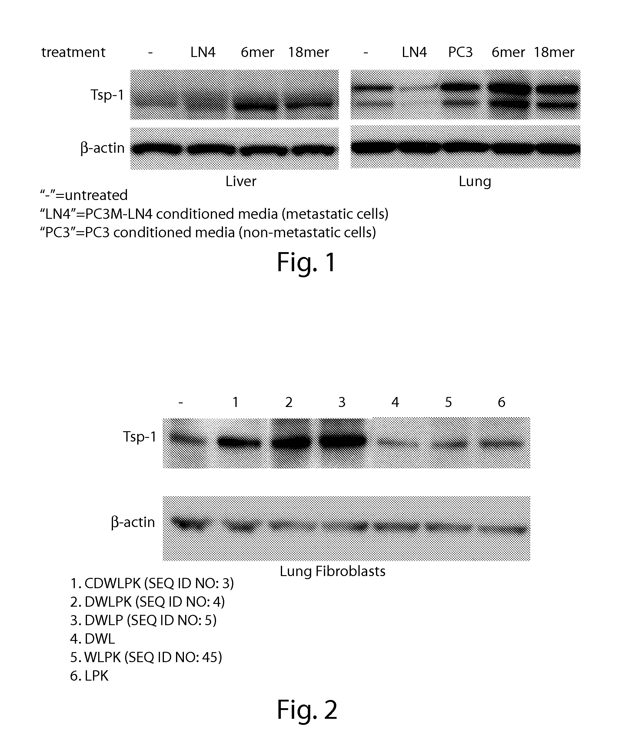 Saposin-a derived peptides and uses thereof