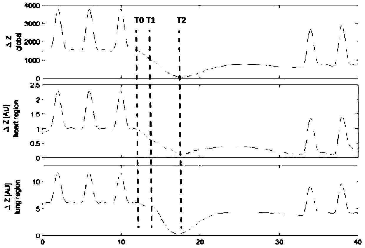 Bedside pulmonary ventilation-blood perfusion impedance tomography method based on saline radiography