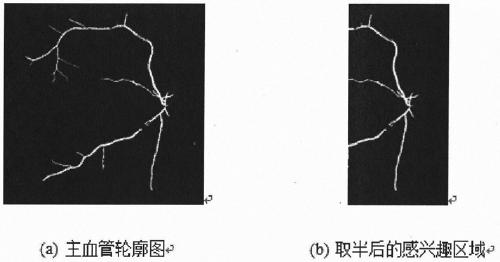 Method for detecting atrophic arc of high myopia fundus image based on machine learning