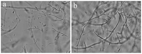 A rapid separation and detection method for fusarium in a sample and the culture medium used