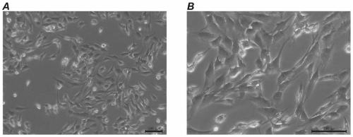 Synovial sarcoma cell line hss-005R and offspring cell line thereof