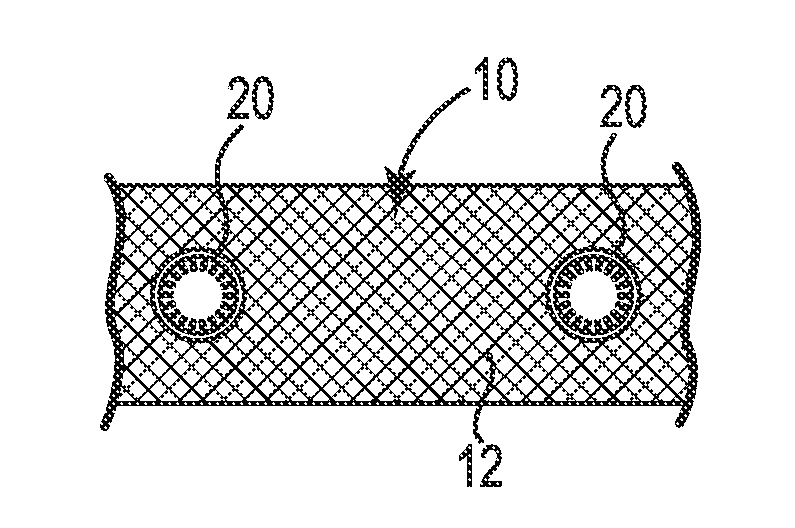 Implant Tissue Fixation System and Method