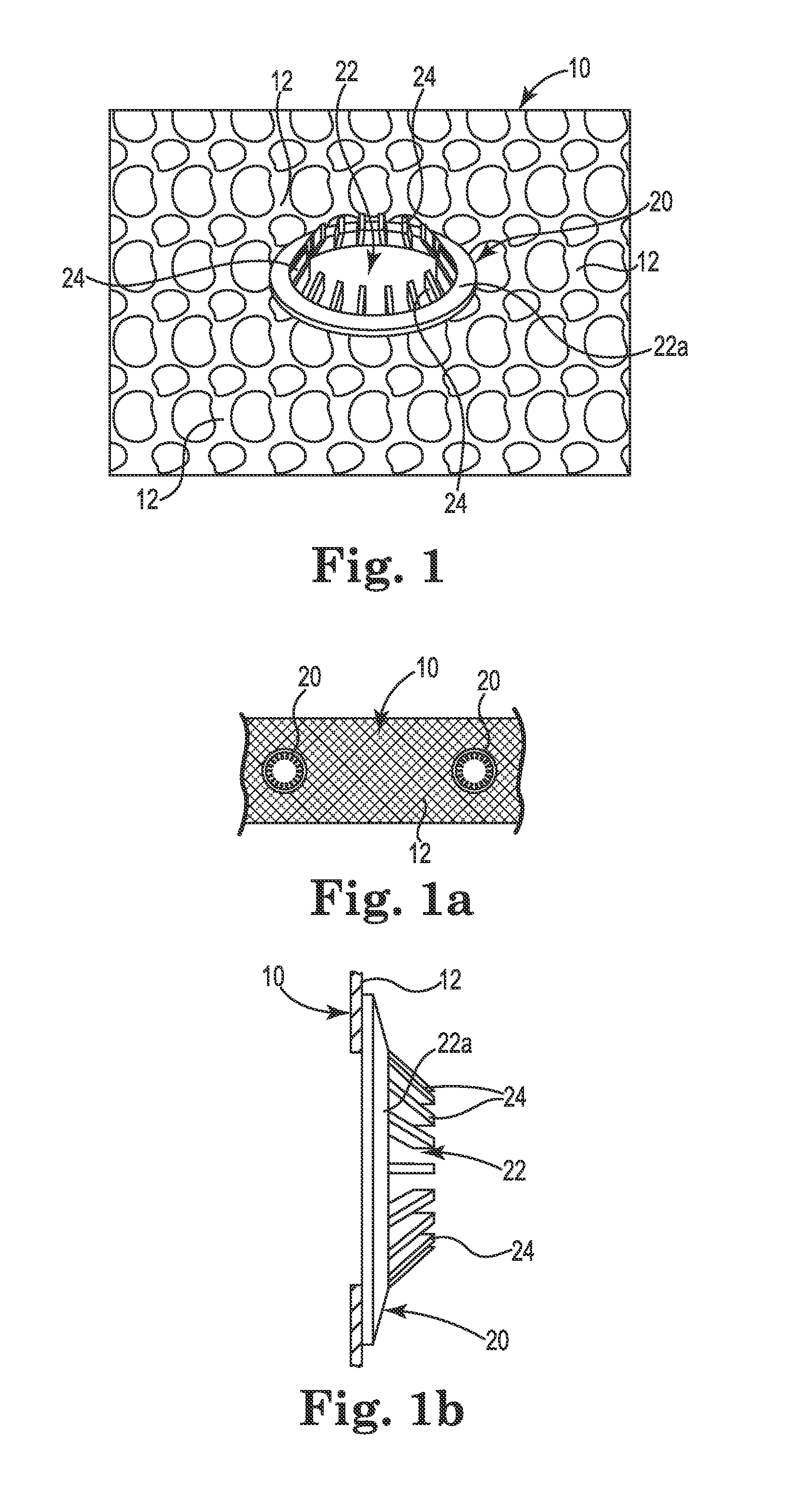 Implant Tissue Fixation System and Method