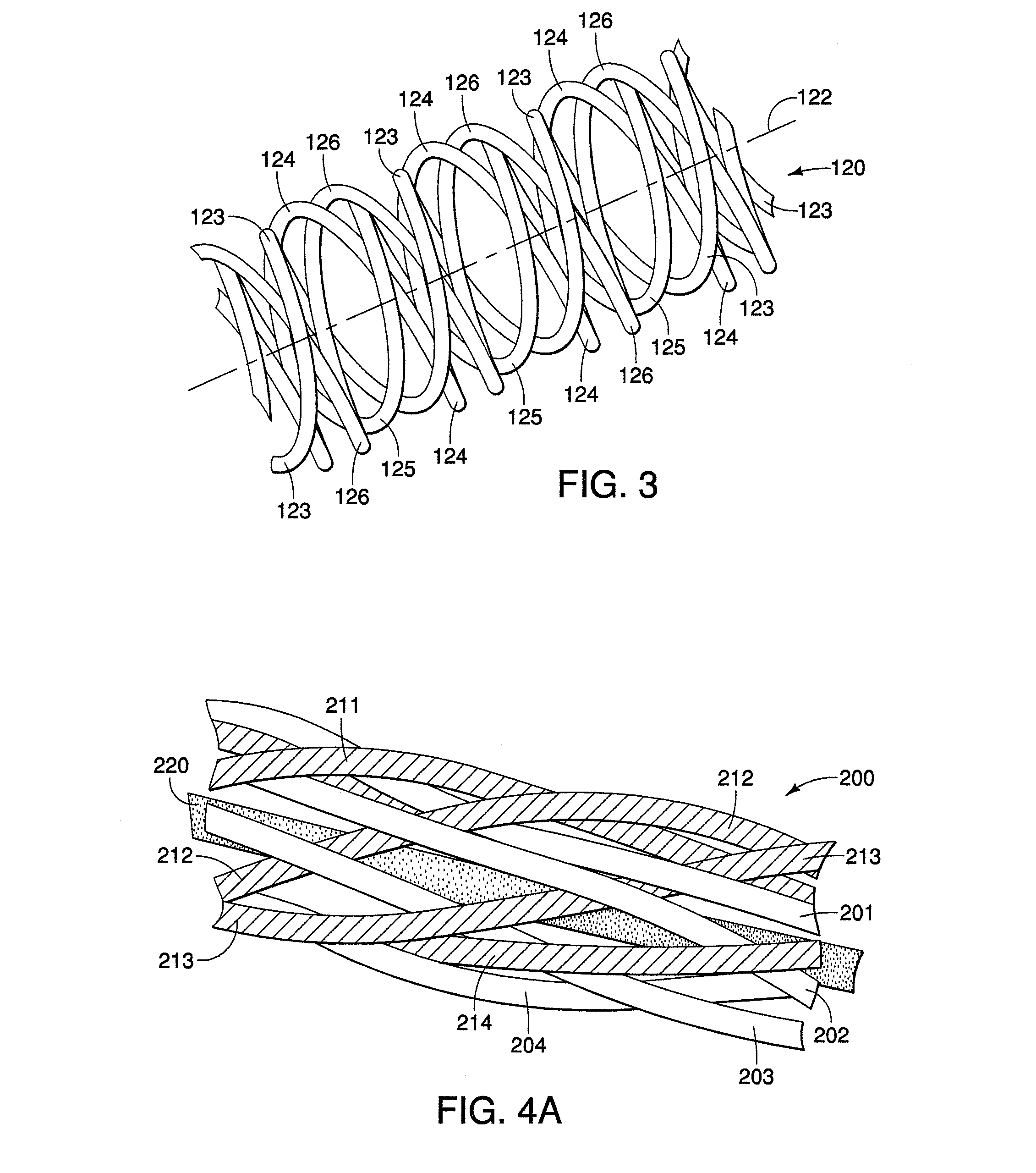 Braided Electrical Lead