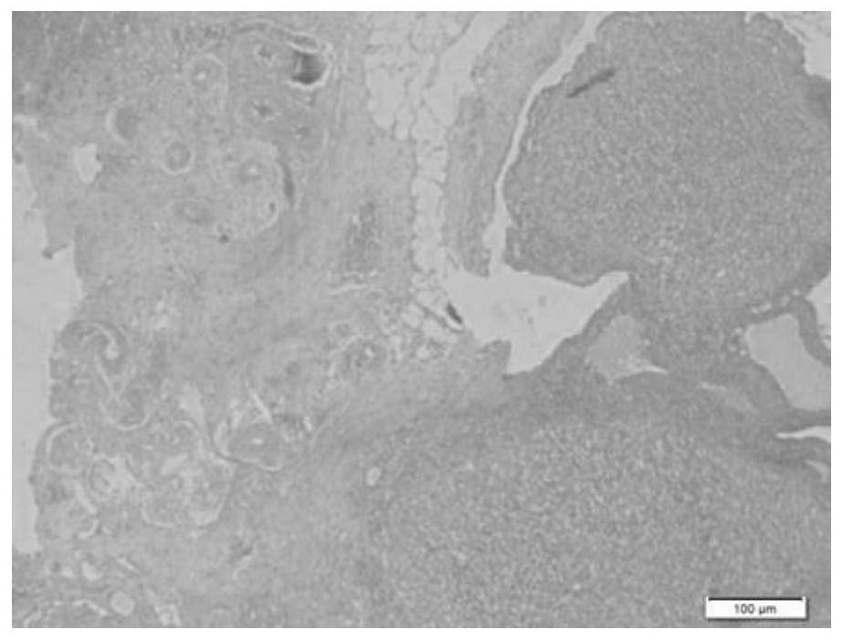 A traditional Chinese medicine composition for treating polycystic ovary syndrome and its preparation method and application