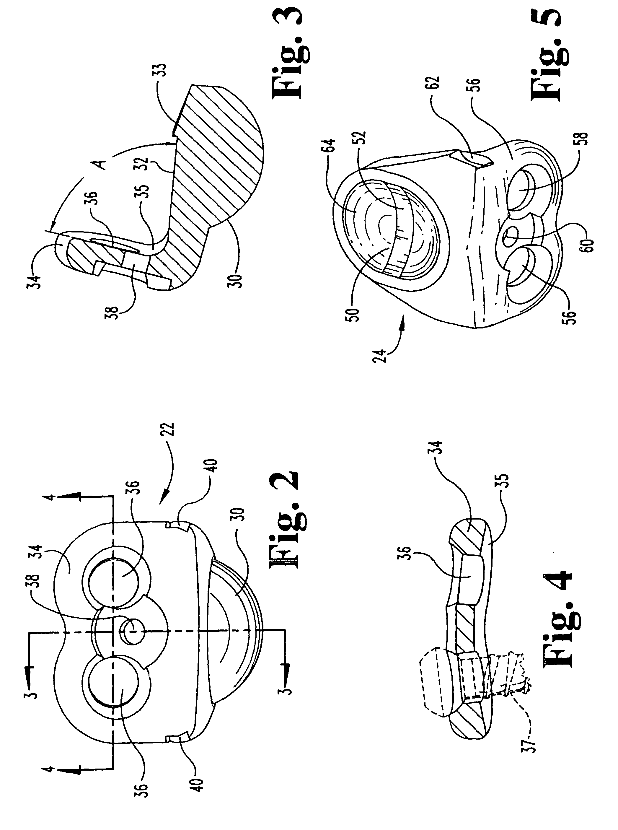 Artificial intervertebral joint permitting translational and rotational motion