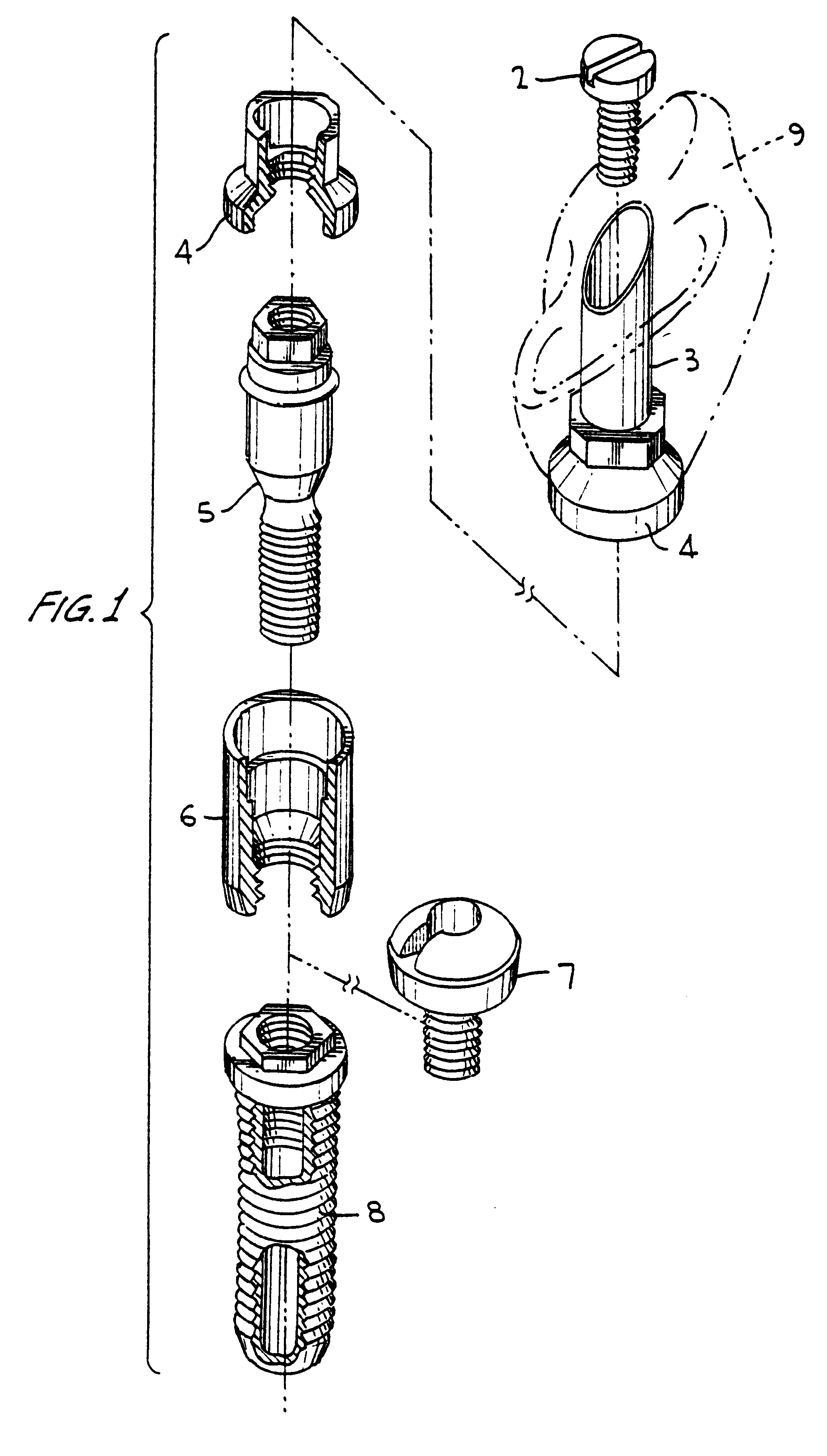 Titanium material implants