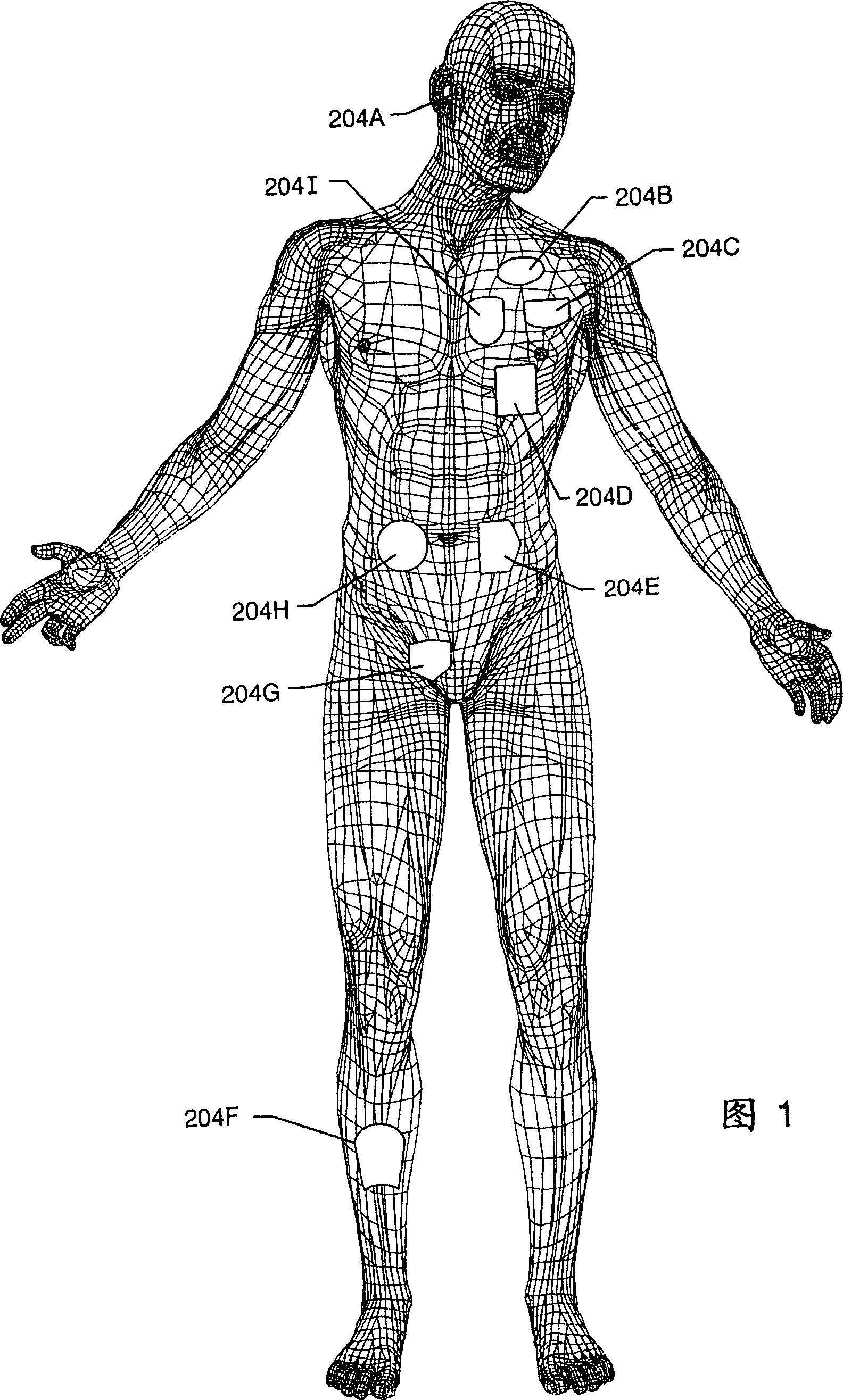 Apparatus and process for reducing the susceptability of active implantable medical devices to medical procedures such as magnetic resonance imaging