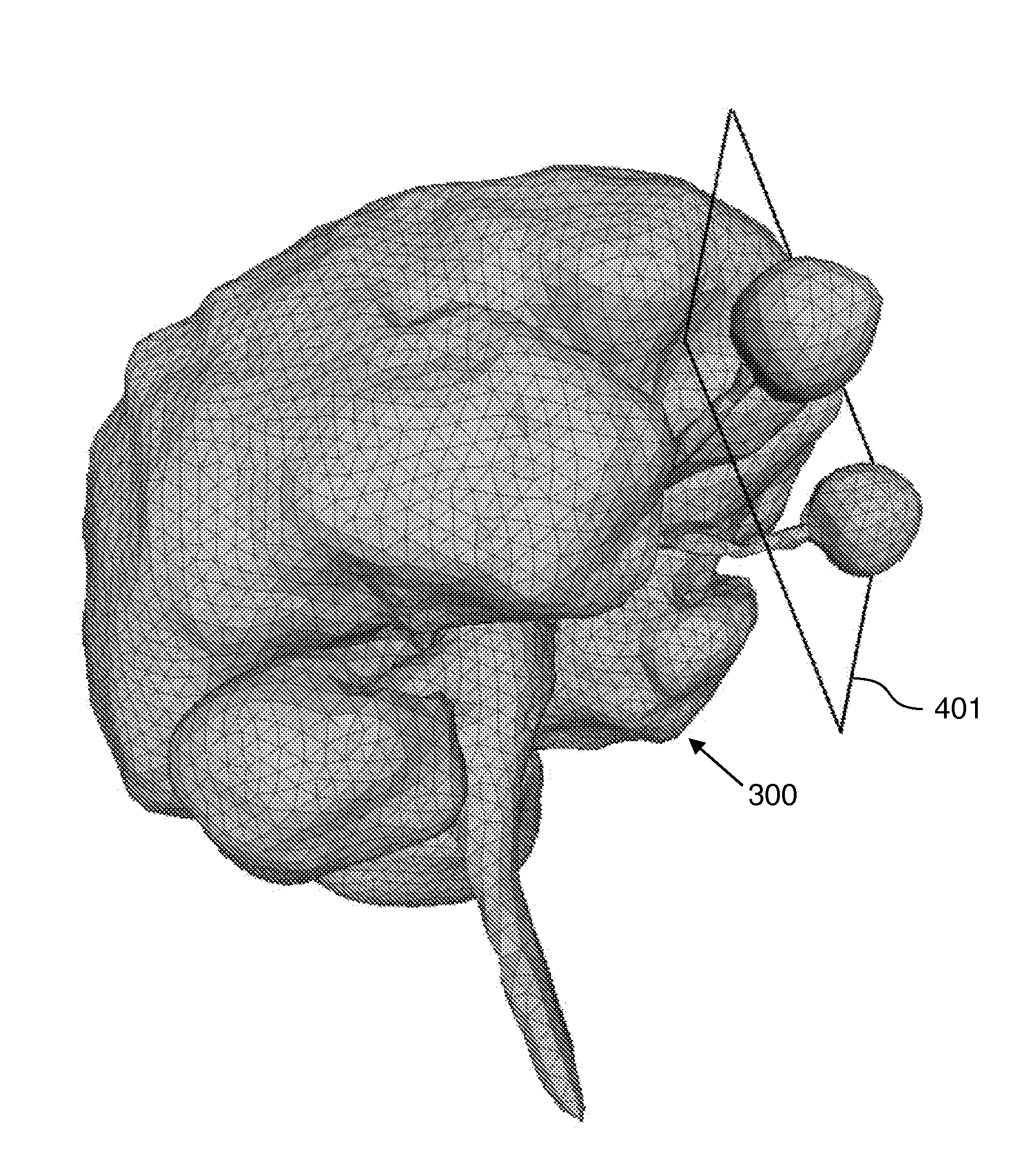 Generating views of medical images